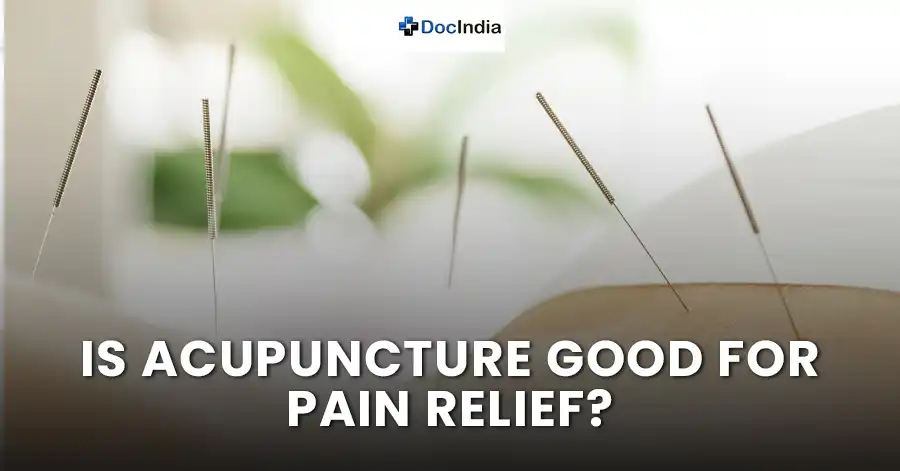 Is acupuncture good for pain relief?