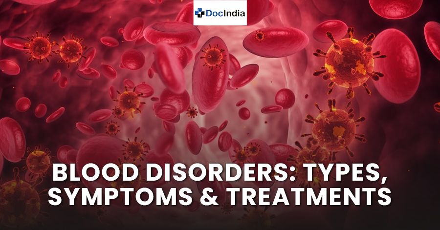 Blood Disorders: Types, Symptoms & Treatments