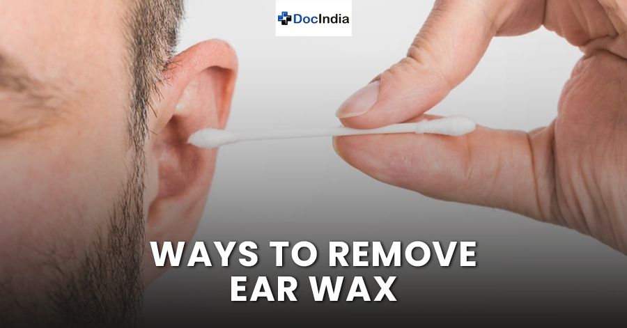 Ways to remove ear wax