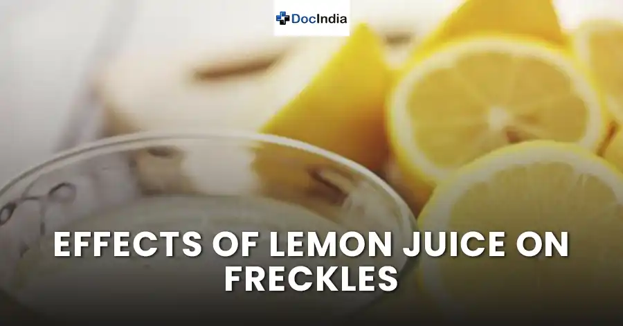 Effects of lemon juice on freckles