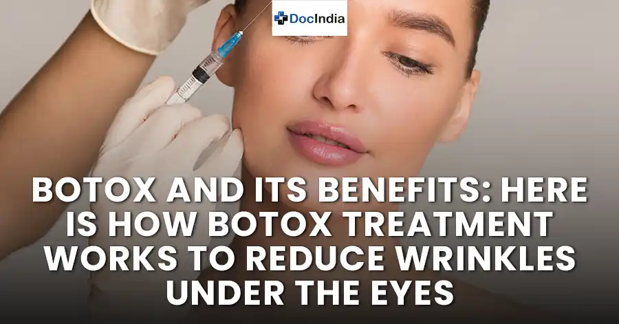 Botox and its benefits: Here is how Botox treatment works to reduce wrinkles under the eyes