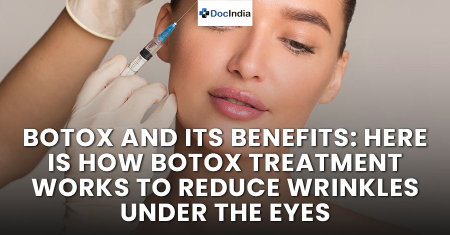 Botox and its benefits: Here is how Botox treatment works to reduce wrinkles under the eyes