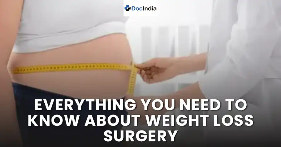 Everything you need to know about weight loss surgery