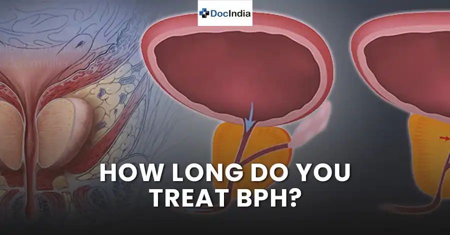 How long do you treat BPH?