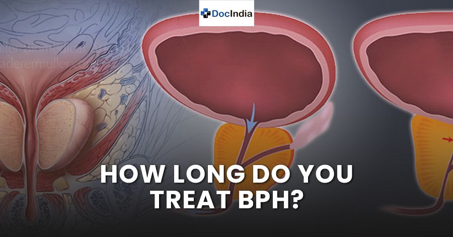 How long do you treat BPH?