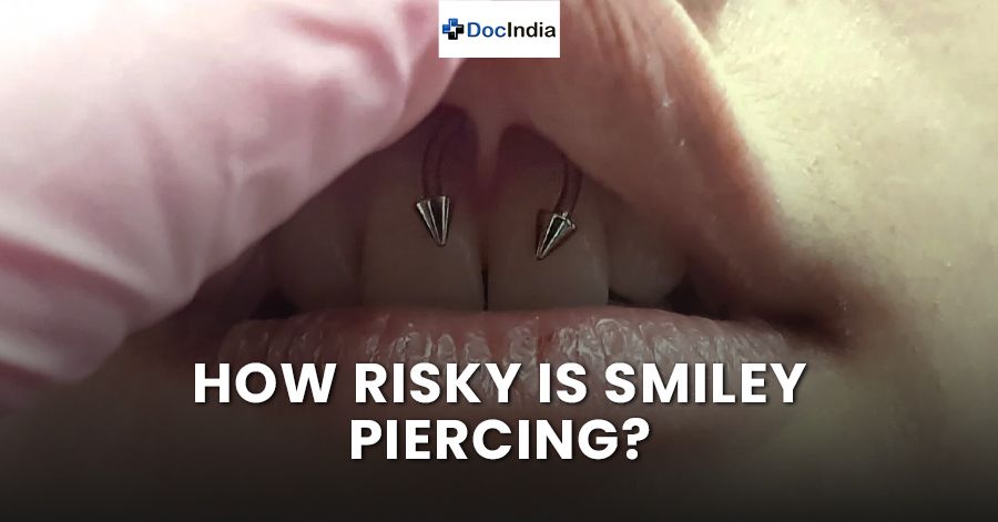 How risky is smiley piercing?