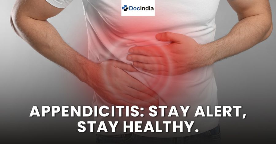 Appendicitis: Stay Alert, Stay Healthy.