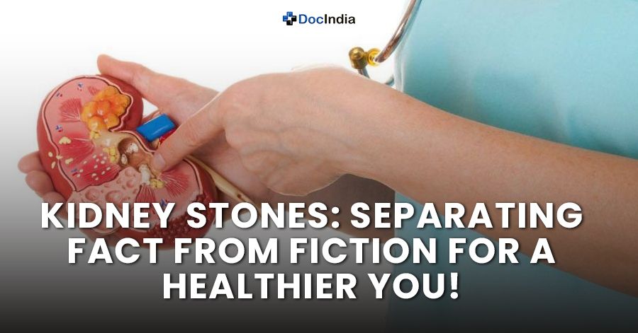 Kidney Stones: Separating Fact from Fiction for a Healthier You!