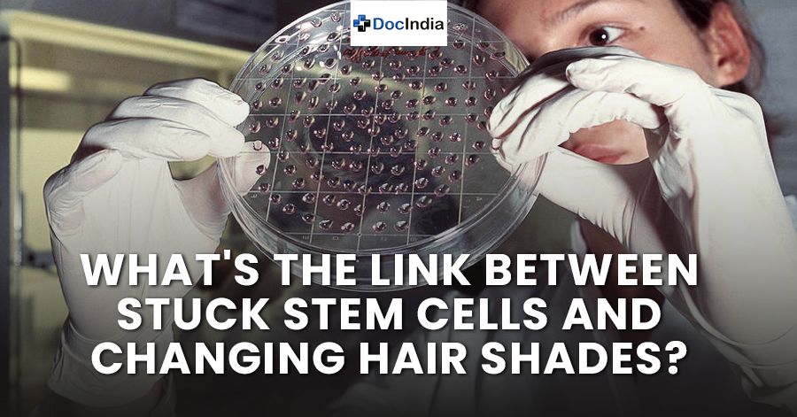 What's the Link Between Stuck Stem Cells and Changing Hair Shades?