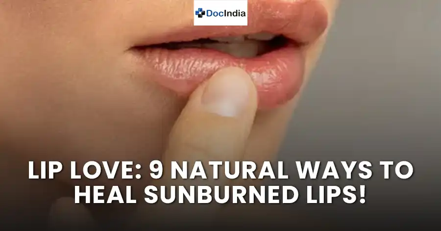 Lip Love: 9 Natural Ways to Heal Sunburned Lips!