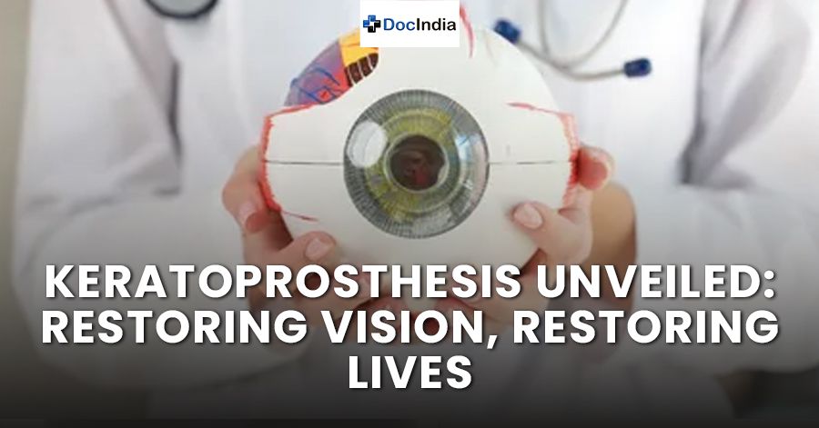 Keratoprosthesis Unveiled: Restoring Vision, Restoring Lives