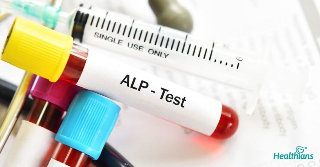 Alkaline Phosphatase Elevation Causes: H