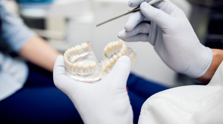 Dental Bridges: Types, Uses, Benefits, a