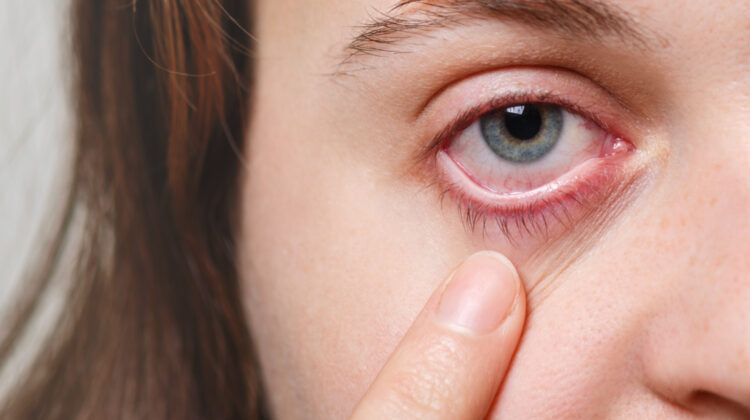 How Can You Prevent Eye Injuries?