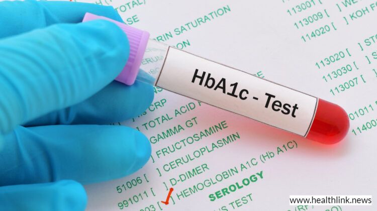 Hemoglobin A1c (HbA1c) Test: What Level Indicates Diabetes?