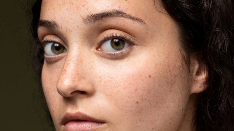 How to Take Care of Your Skin and Avoid Blackheads?