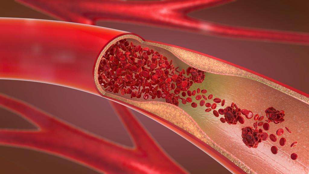 How to increase blood flow to penis – Docindia.org