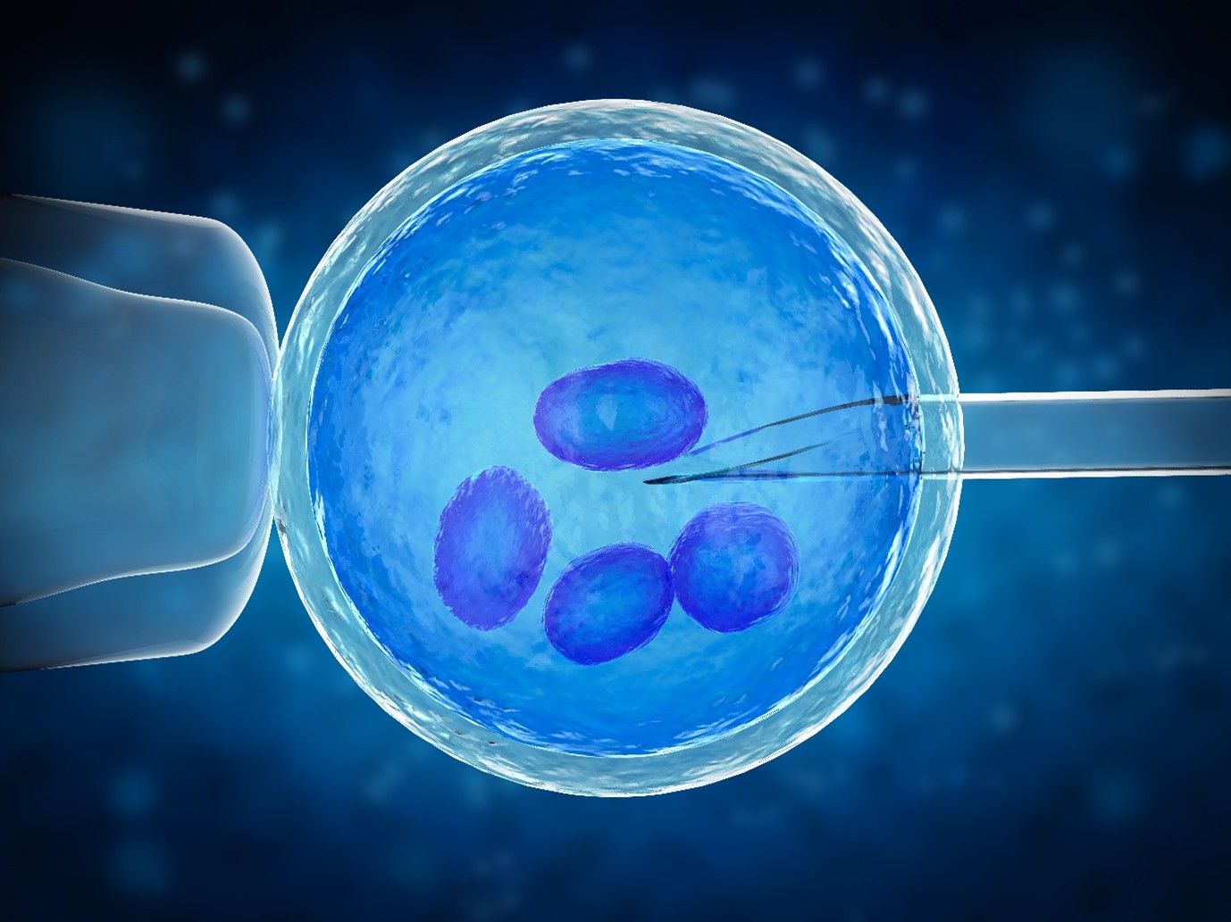 IVF Treatment at Indore