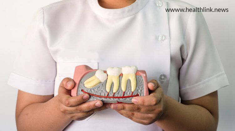 Impacted Wisdom Teeth: Best Home Remedies For Pain Relief