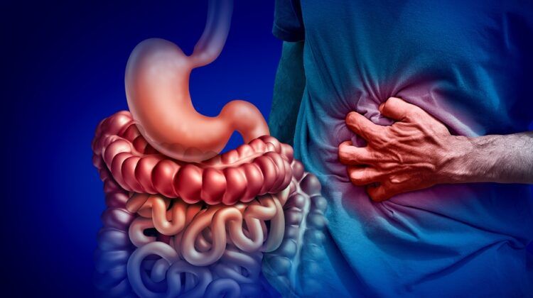 Myths and Facts of Irritable Bowel Syndrome (IBS)