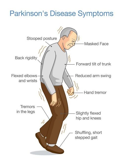 Parkinsons-Disease-Symptoms.jpg