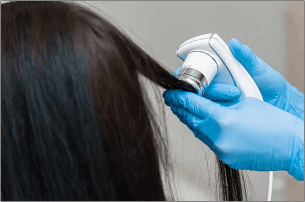 Laser Hair Removal in Whitefield: What to Expect at a Hair Care Clinic in Bangalore