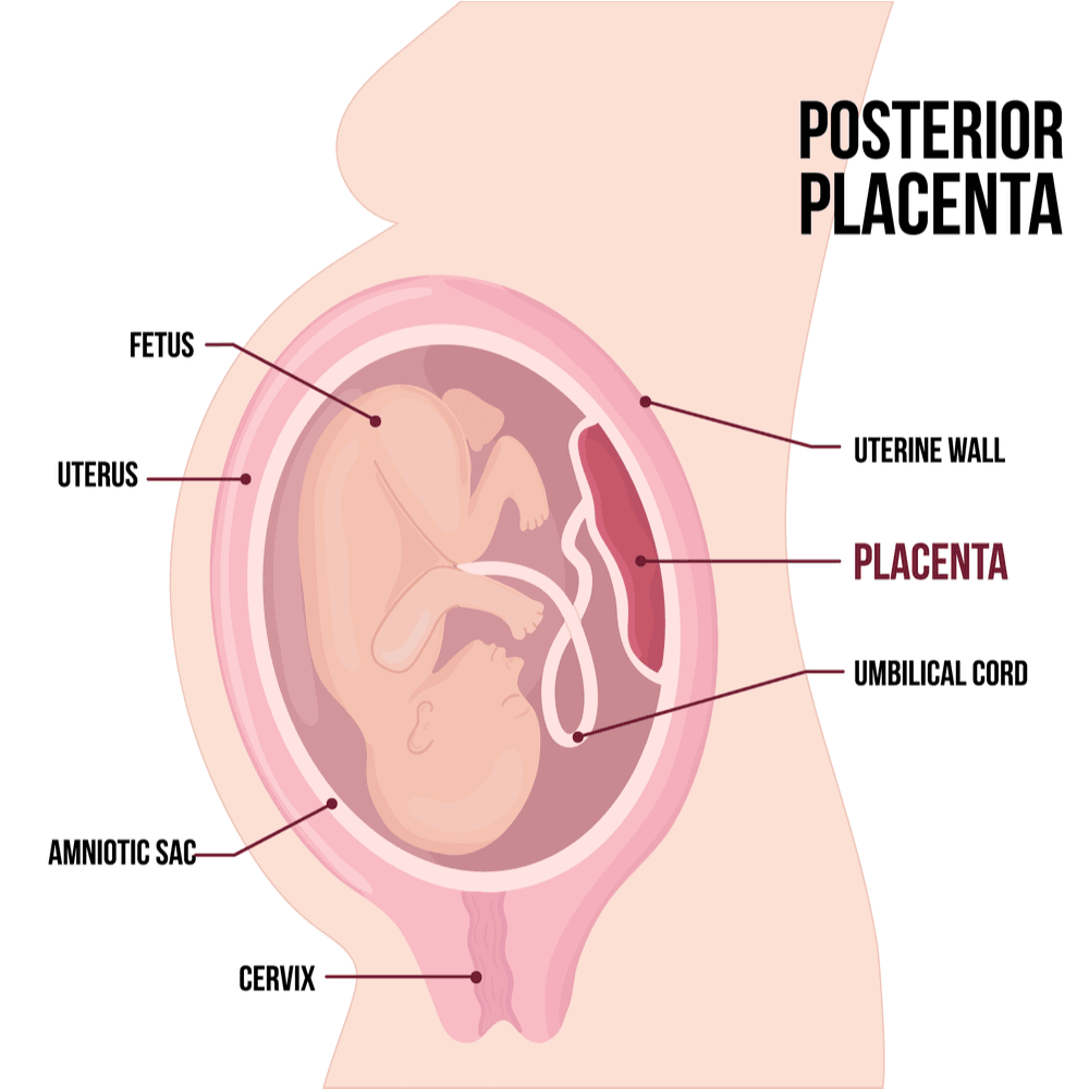 Placental-previa.png