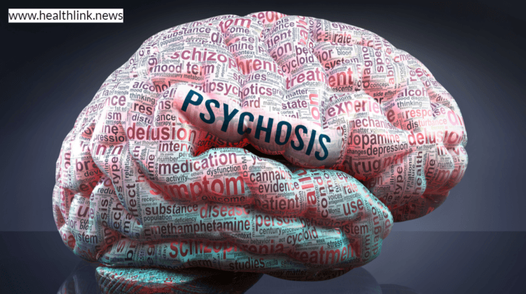 Psychosis: Symptoms, Causes, Types, and Effects