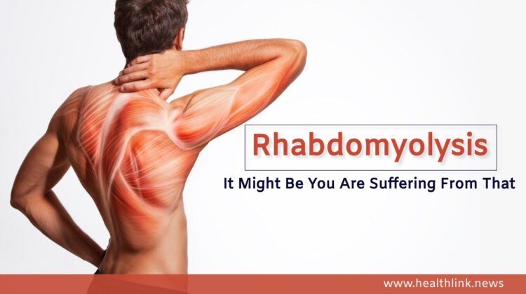 Rhabdomyolysis: Causes, Prevention and Treatment Options