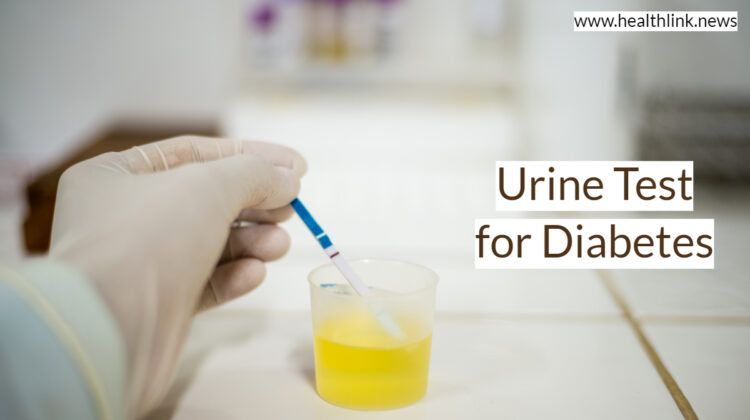 Urine Test for Diabetes or Glucose Levels?