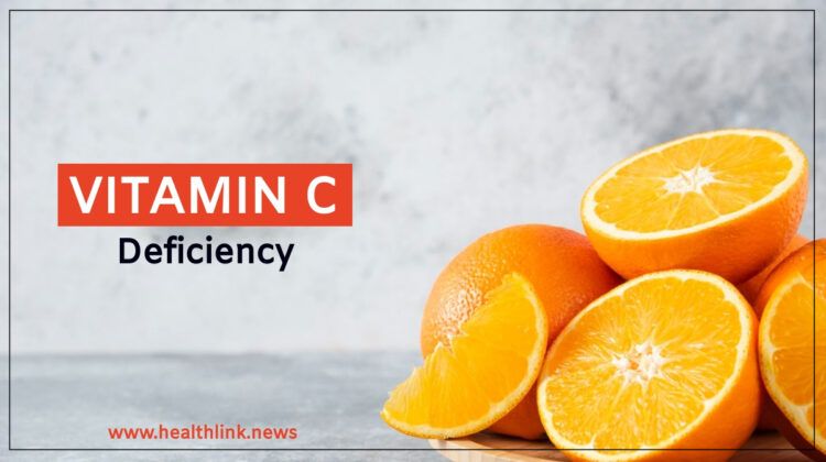 Vitamin C Deficiency: 15 Common Signs and Symptoms