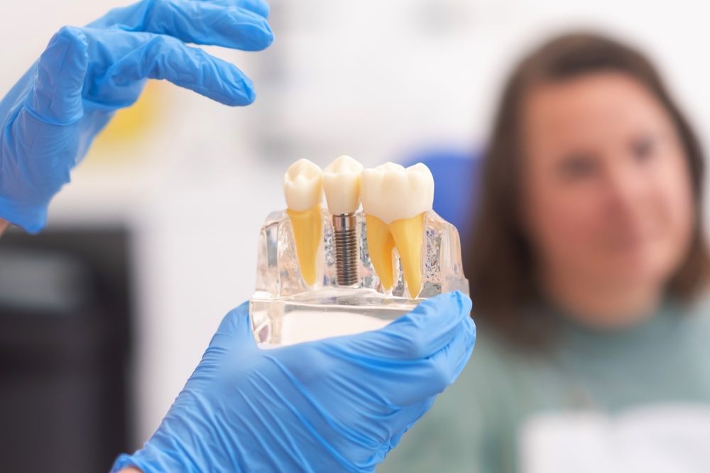 Why do you need to perform dental implant procedures? 