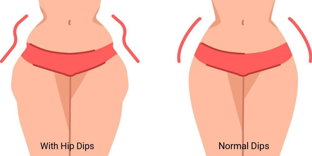 normal-dips-and-hip-dips.jpg
