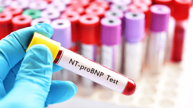 NT-proBNP Test: Purpose, Age-Based Normal Ranges & Meaning
